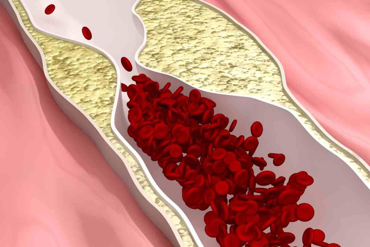 arterie pulite olio di riso