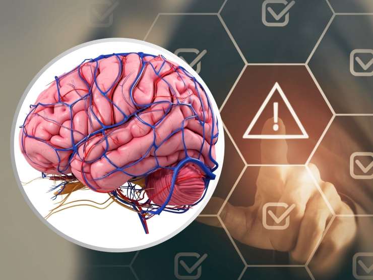 Il lavoro eccessivo modifica il cervello: le nuove scoperte che ti sorprenderanno