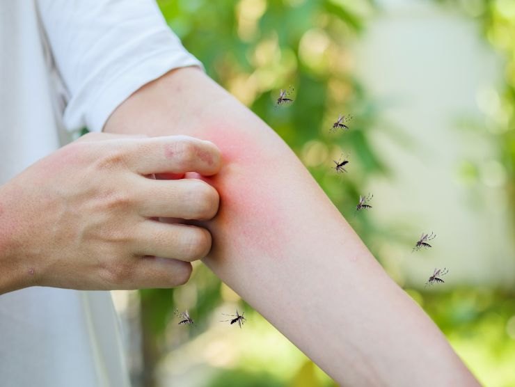 persona punto dalle zanzare che si gratta sul braccio